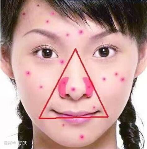鼻頭長痘