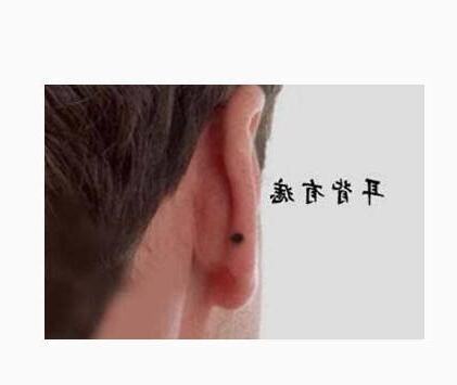 命門有痣