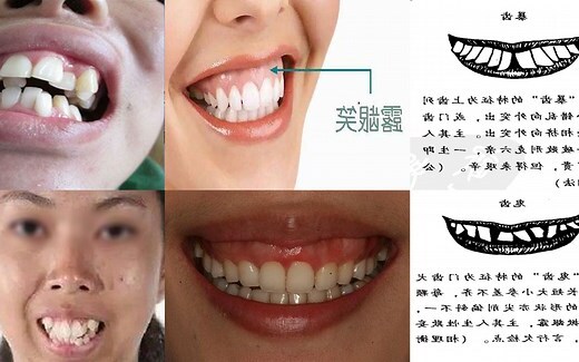 牙齿面相