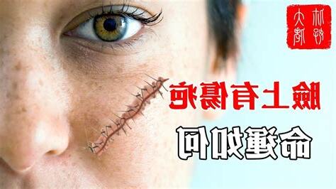 臉上有疤面相
