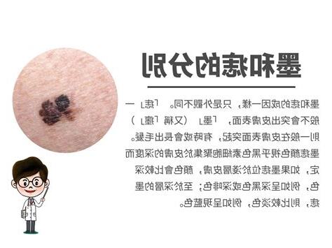 墨痣