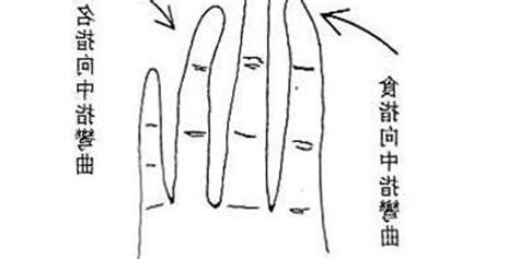 天生手指彎曲