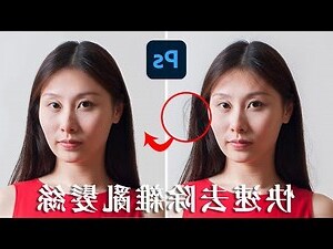 頭髮遮住額頭