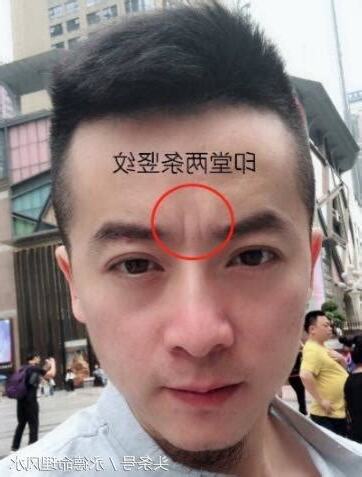 眉間有直紋