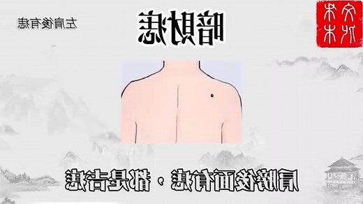 左邊肩膀有痣