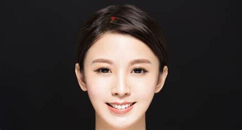 額角有痣