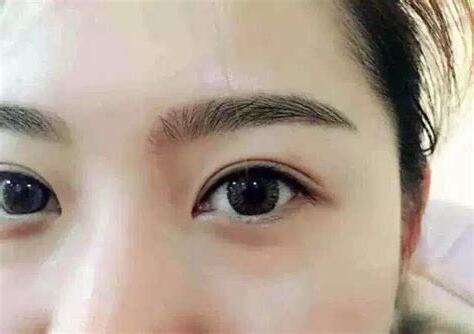 眉毛癢代表什麼