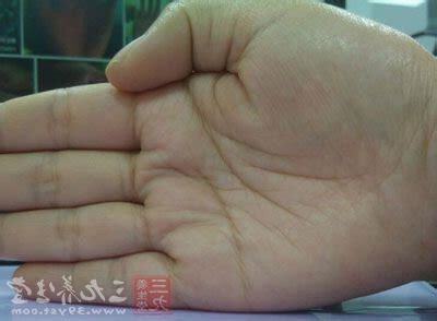 手心癢代表什麼