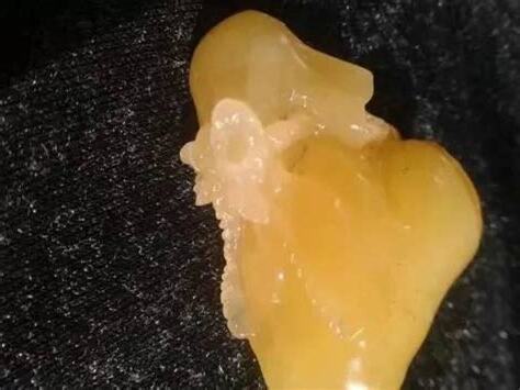 戴琥珀的好處