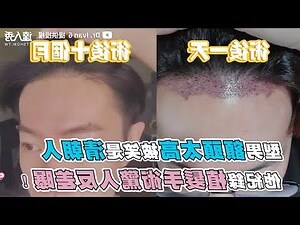 額頭破相
