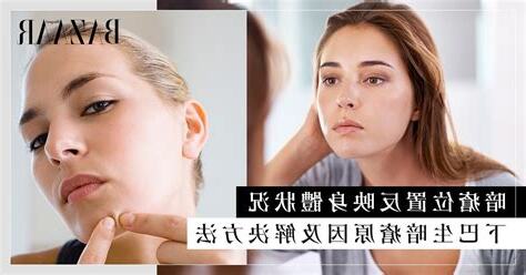 下巴生暗瘡解決方法