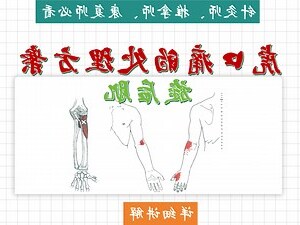 虎口位