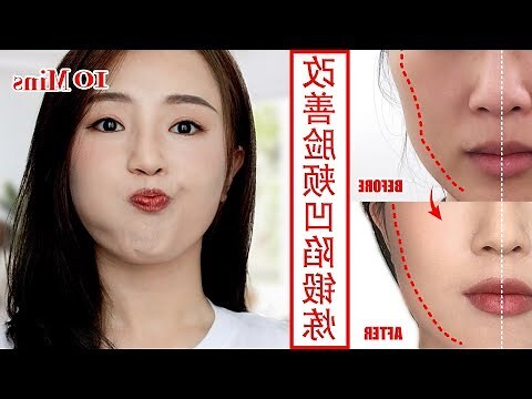 額頭凹陷原因