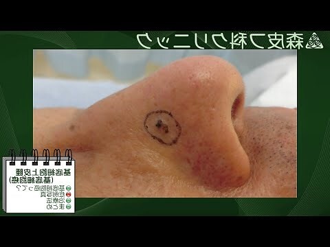 夢見別人皮膚病