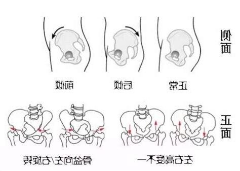 歪斜的意思