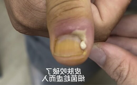 咬手指