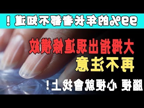 大拇指橫紋