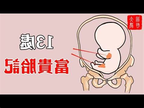 小腿胎記