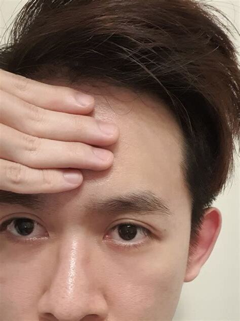 4指額頭