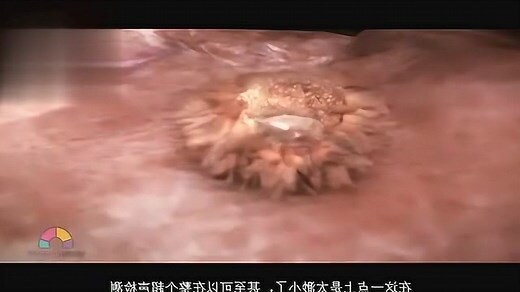 懷孕可以移床嗎