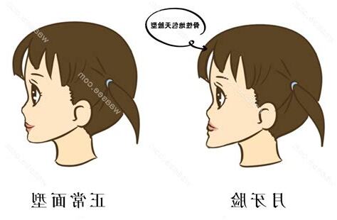 地包天