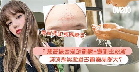 額頭暗瘡解決