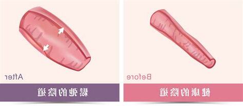 陰道無毛