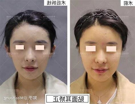 正面看不到耳朵