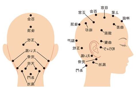 頭部氣結