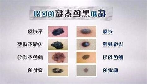 陰莖黑黑的