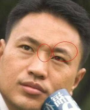 牢獄之災面相