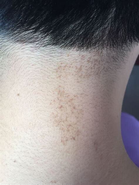 脖子有黑斑