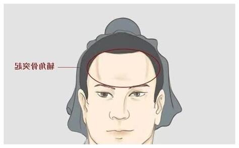 觭角