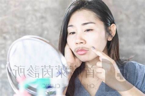 臉部長毛