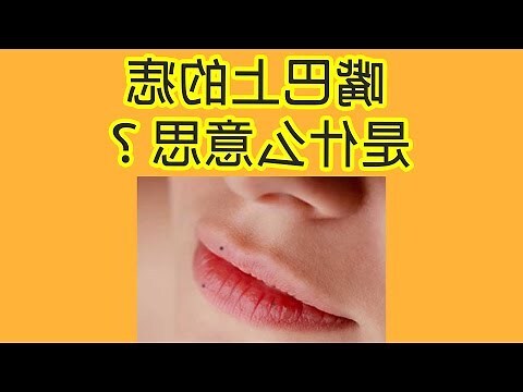 臉上的痣的意思