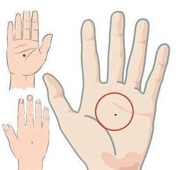 手掌心有痣代表什麼