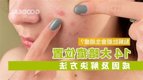 人中位置生暗瘡