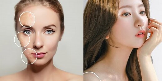 額頭長痘痘面相