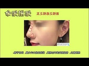 鼻子上面有痣