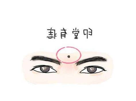 印堂痣