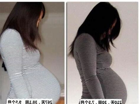 懷孕一個月肚子
