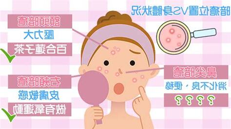 暗瘡位置意思