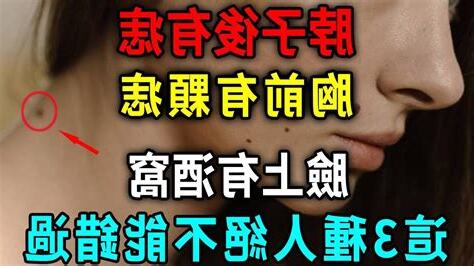 頸前有痣