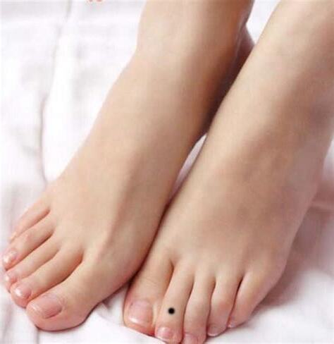 腳趾縫有痣