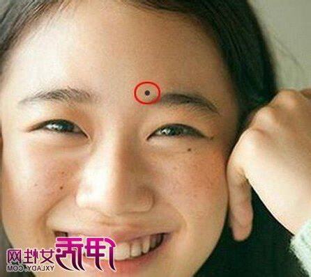 眼睛下面長痣