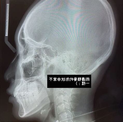 牙齒小的人