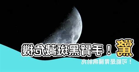 手臂長黑斑