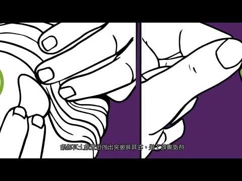 耳貼是什麼