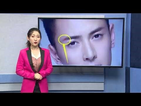 右眉毛上方有痣