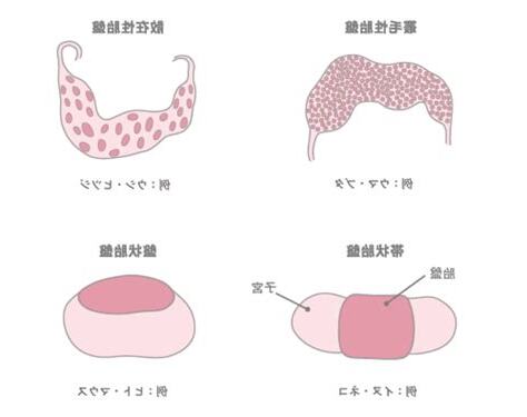 動物胎盤